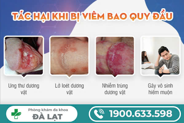 Hình ảnh minh họa